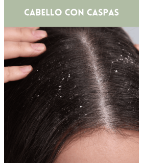 Pack cabellos con caspa FAUVERT